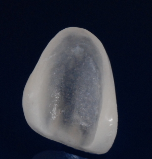 Real translucent porcelain veneer shell photographed against a dark background